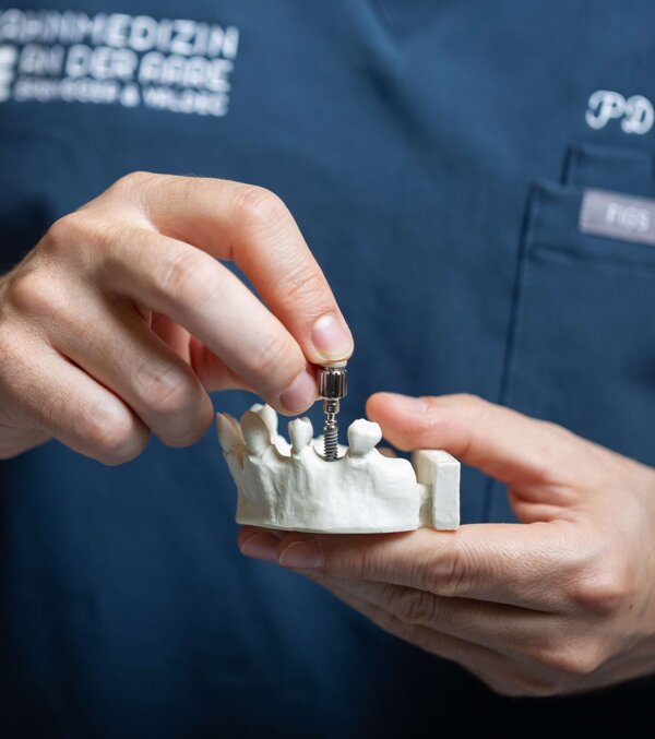 PD Dr. Silvio Valdec hält ein Zahnmodell mit eingeschraubtem Implantat. Nahaufnahme des Modells.